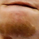 Illustration for article titled Whose Disgusting Baseball Chin Is This?